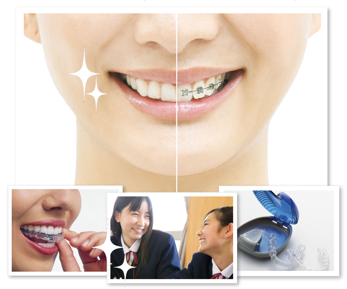 ▼マウスピース矯正 ▼ブラケット矯正